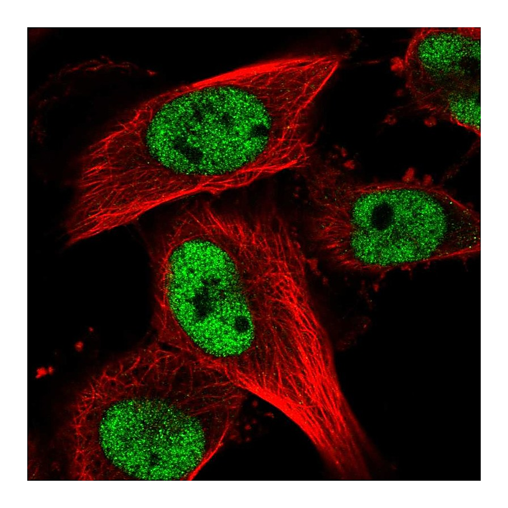 Atlas Antibodies Anti-RBM15B Antibody