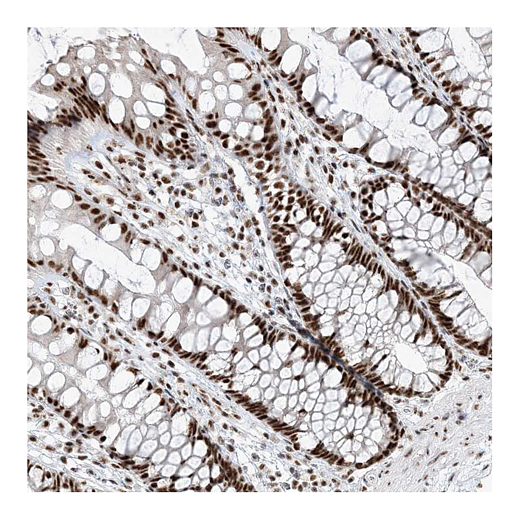 Atlas Antibodies Anti-RBM17 Antibody