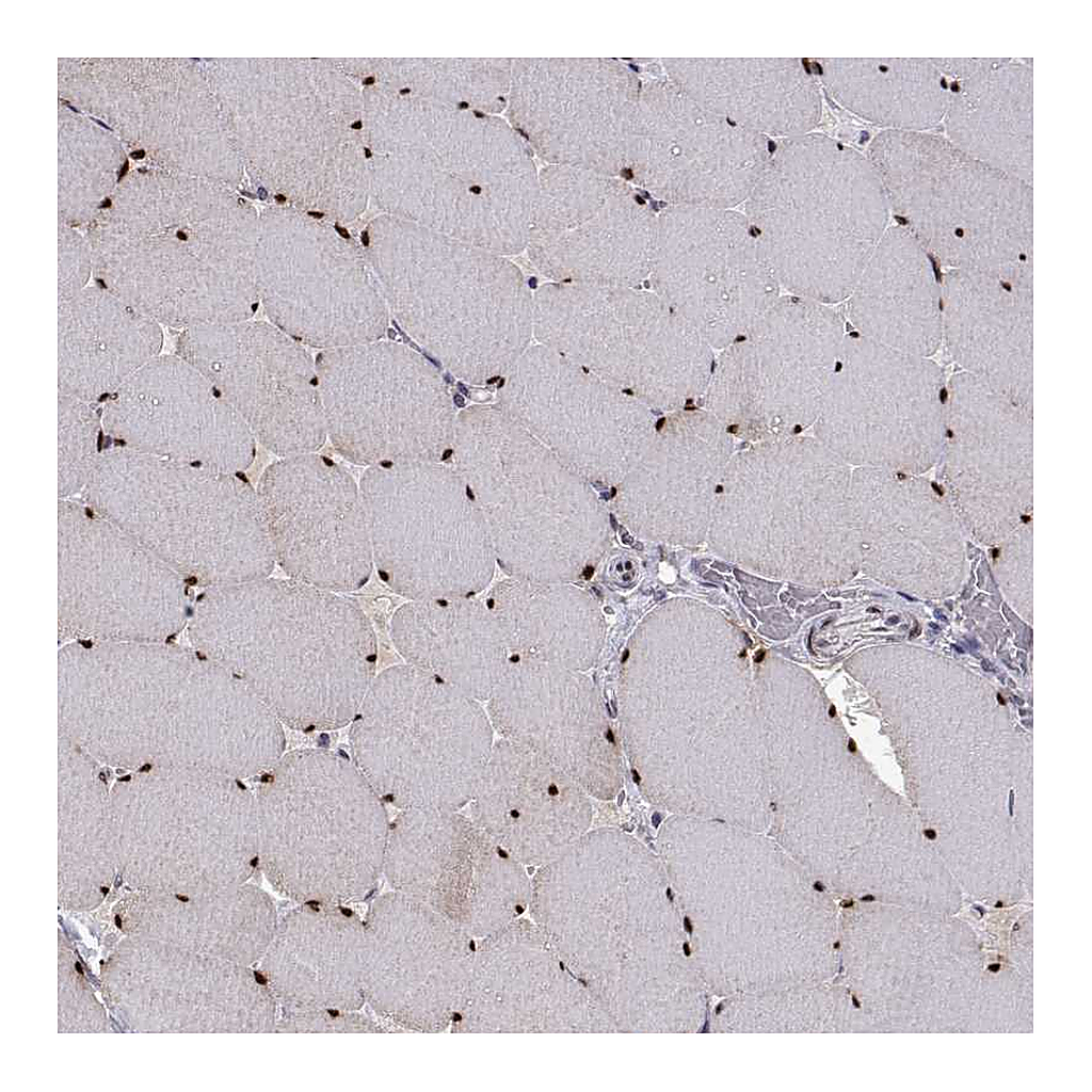 Atlas Antibodies Anti-RBM24 Antibody