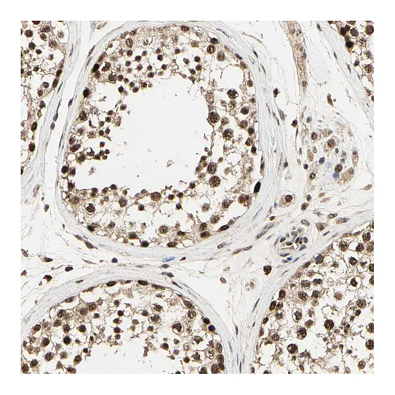 Atlas Antibodies Anti-RBM25 Antibody