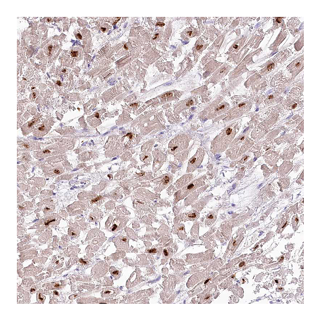 Atlas Antibodies Anti-RBM20 Antibody