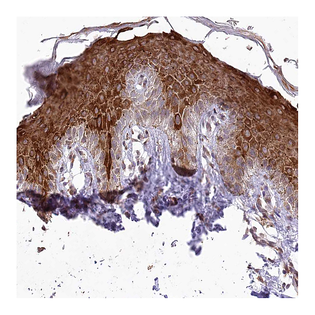 Atlas Antibodies Anti-RBM27 Antibody