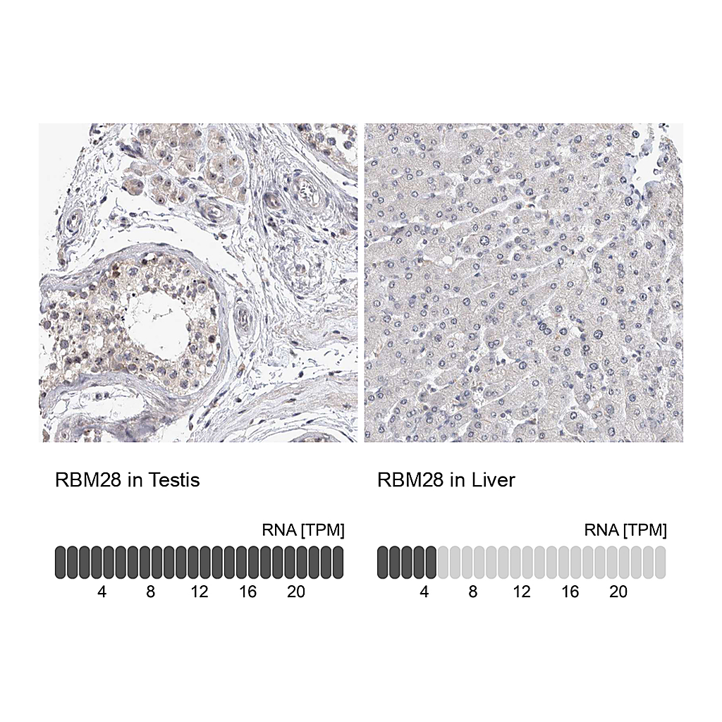 Atlas Antibodies Anti-RBM28 Antibody
