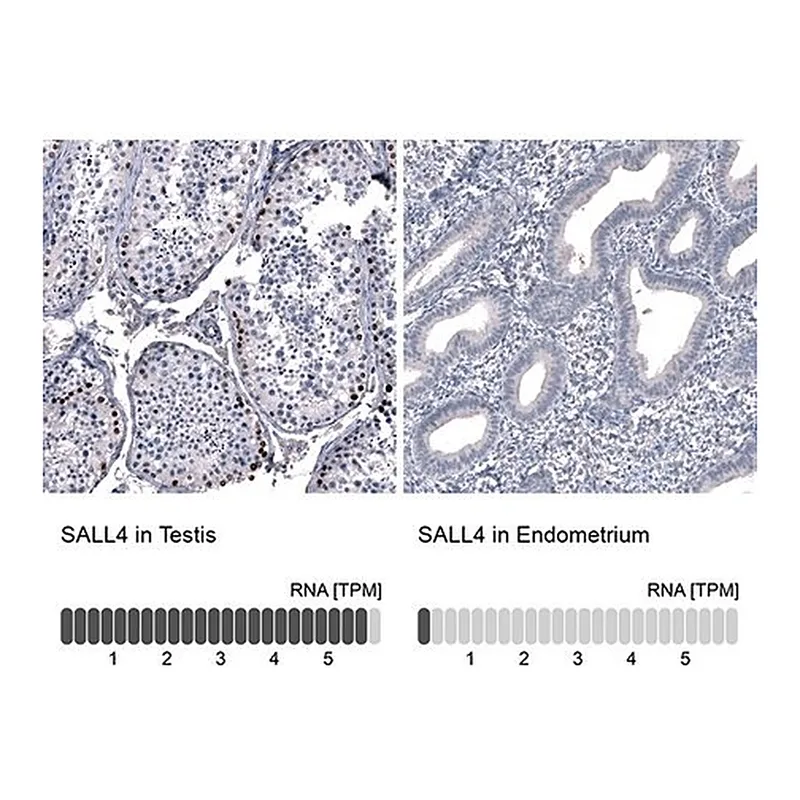 Merck Monoclonal Anti-SALL4 antibody produced in mouse