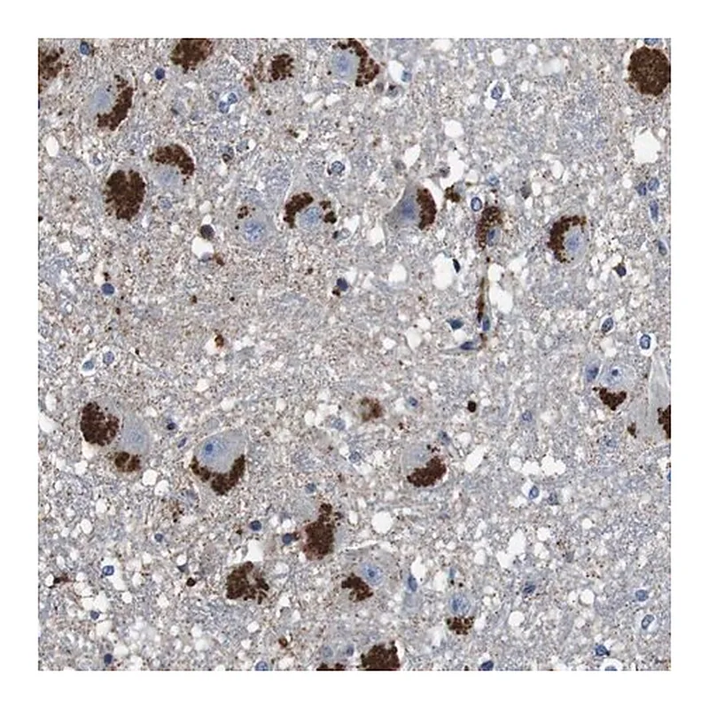 Merck Anti-CYP2W1 antibody produced in rabbit