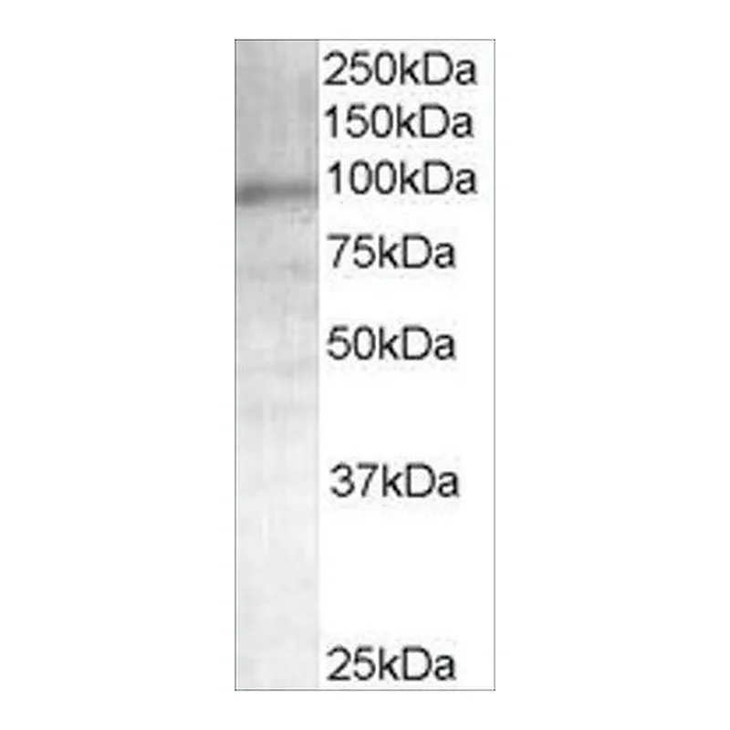 Merck Anti-Androgen Receptor antibody produced in goat