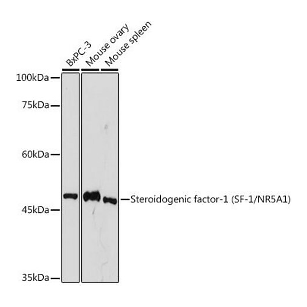 Merck Anti-Steroidogenic factor-1 (SF-1/NR5A1) antibody produced in rabbit