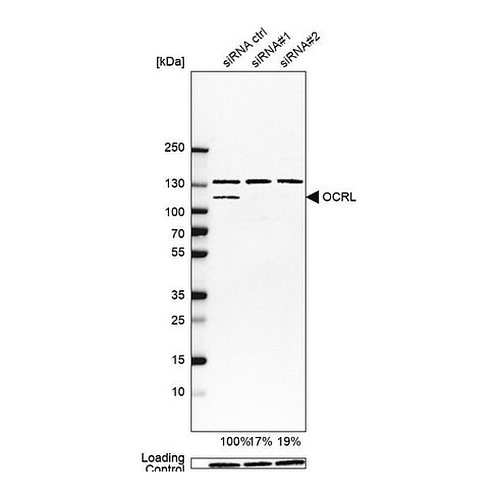 Merck Anti-OCRL antibody produced in rabbit