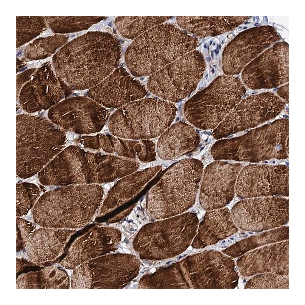 Merck Anti-UBE3C antibody produced in rabbit
