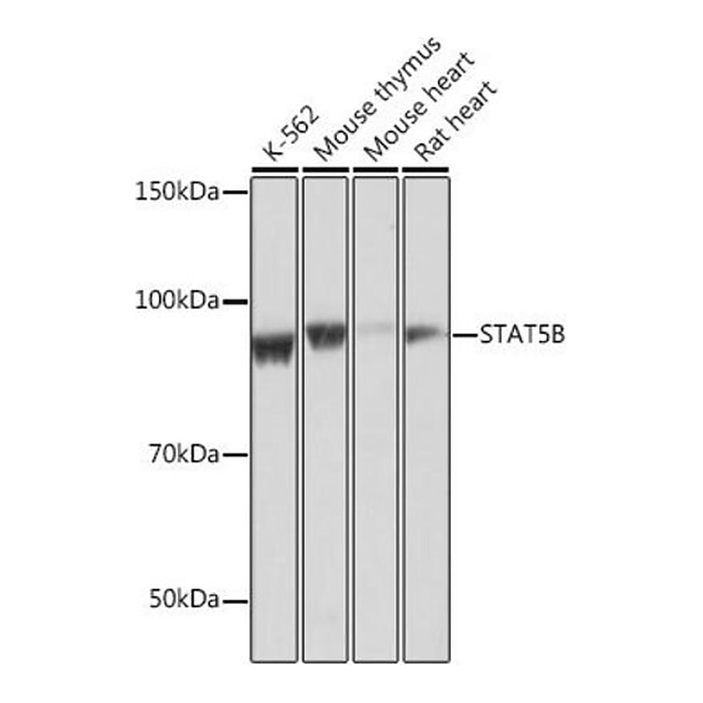 Merck Anti- STAT5B antibody produced in rabbit