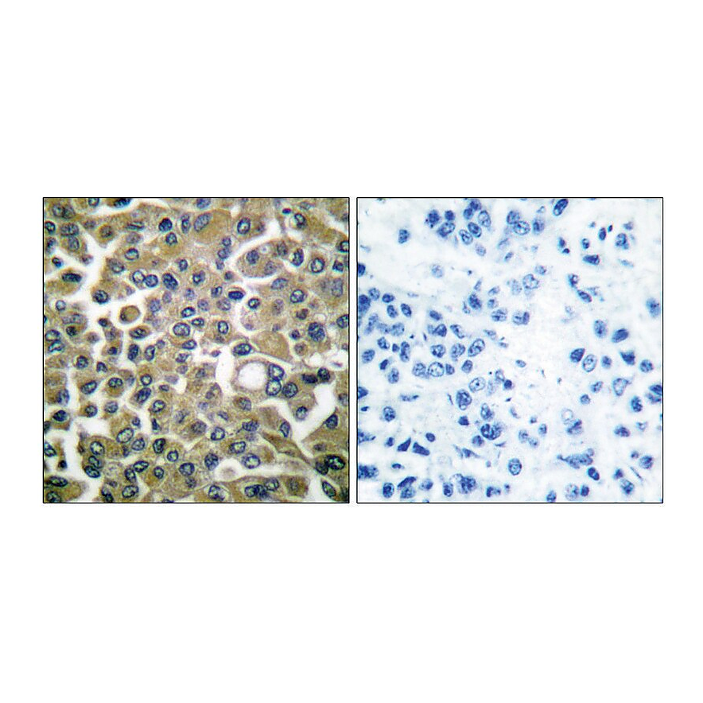 Merck Anti-Keratin 16 antibody produced in rabbit