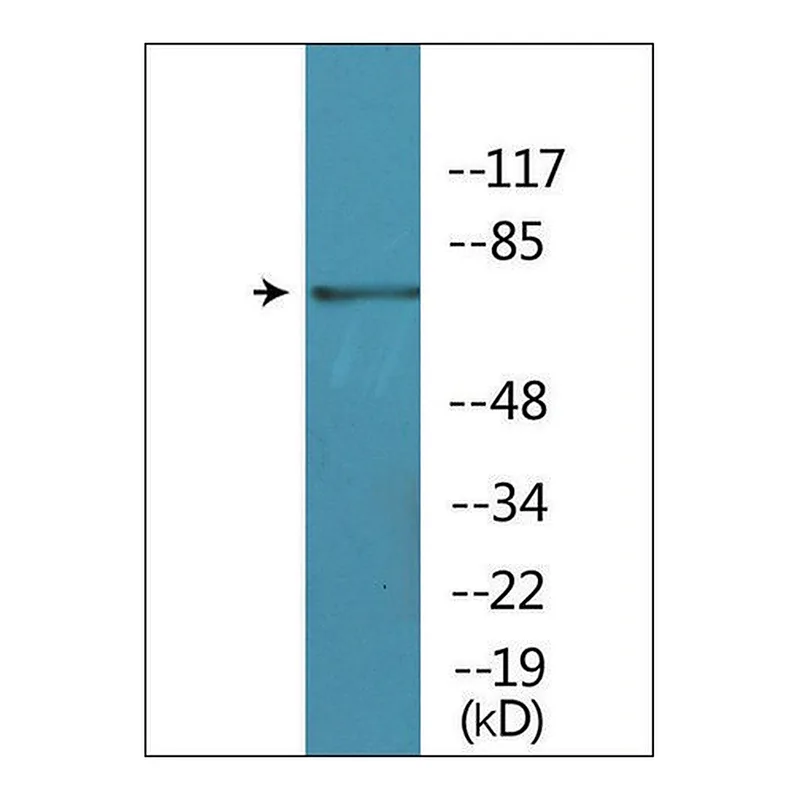 Merck Anti-phospho-BTK (pTyr551) antibody produced in rabbit