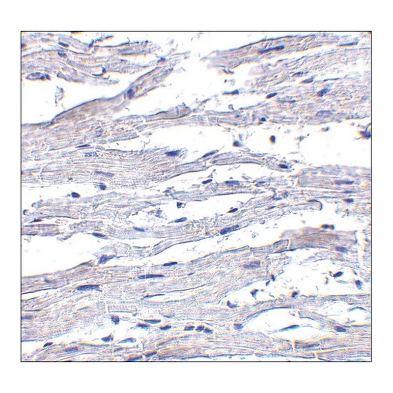 Merck Anti-RIG-1 antibody produced in rabbit