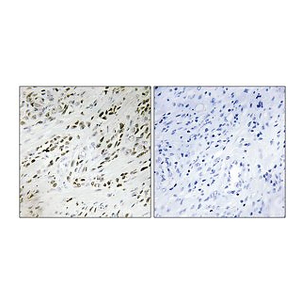 Merck ANTI-TSH2 ANTIBODY PRODUCED IN RABBIT