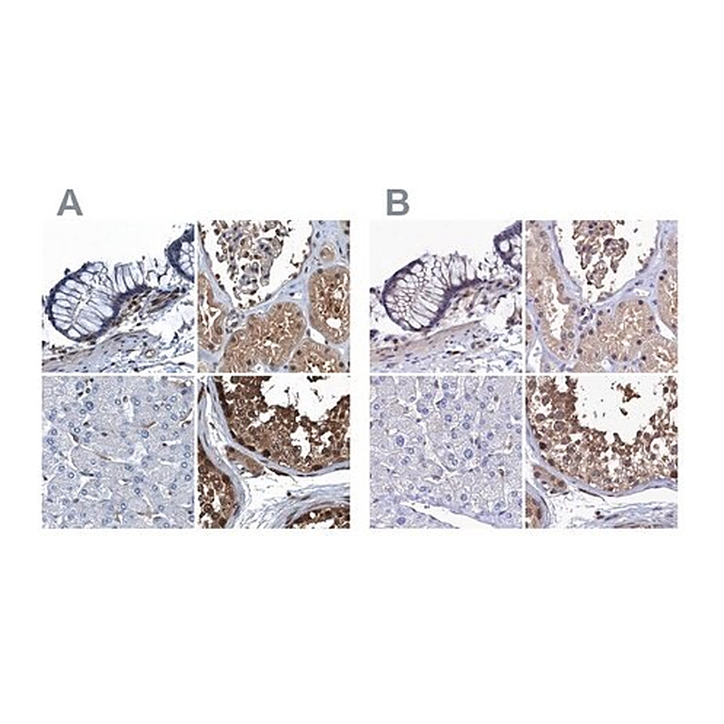 Merck Anti-RNH1 antibody produced in rabbit