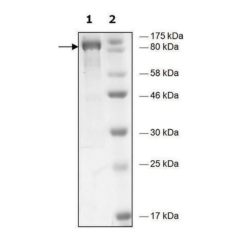 Merck HDAC6 H611A human
