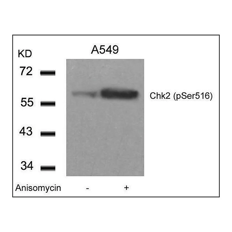 Merck Anti-phospho-CHEK2 (pSer516) antibody produced in rabbit