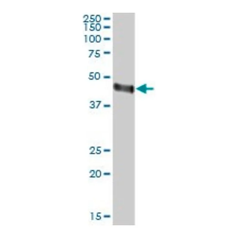 Merck Anti-ORM2 antibody produced in mouse