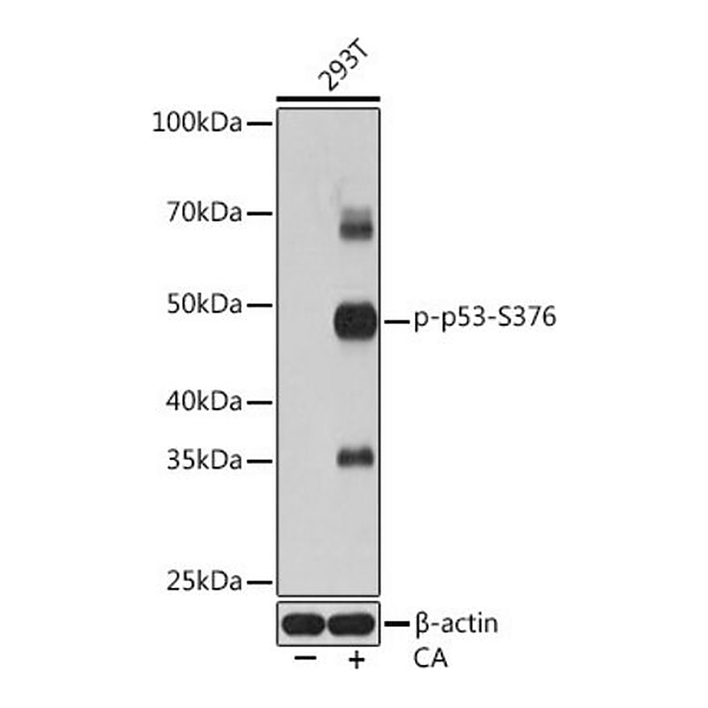 Merck Anti-Phospho-p53-S376 antibody produced in rabbit
