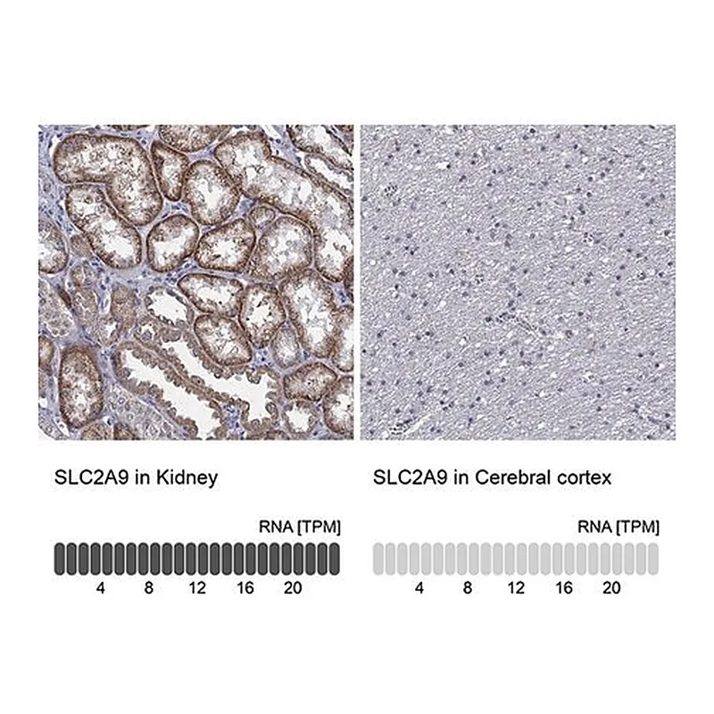 Merck Anti-SLC2A9 antibody produced in rabbit