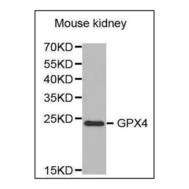 Merck Anti-GPX4 antibody produced in rabbit