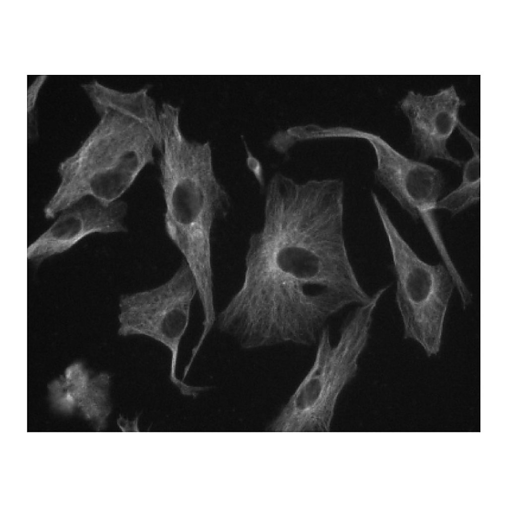 BD Purified Mouse Anti-β-Tubulin