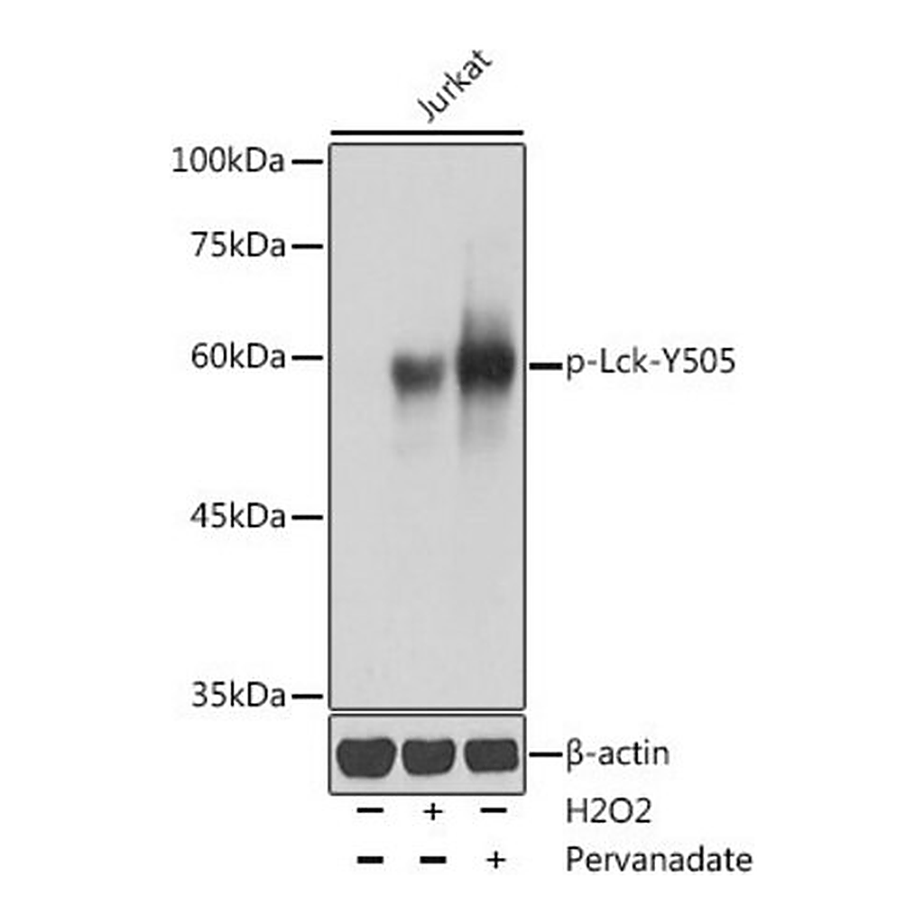 Merck Anti-Phospho-Lck-Y505 antibody produced in rabbit