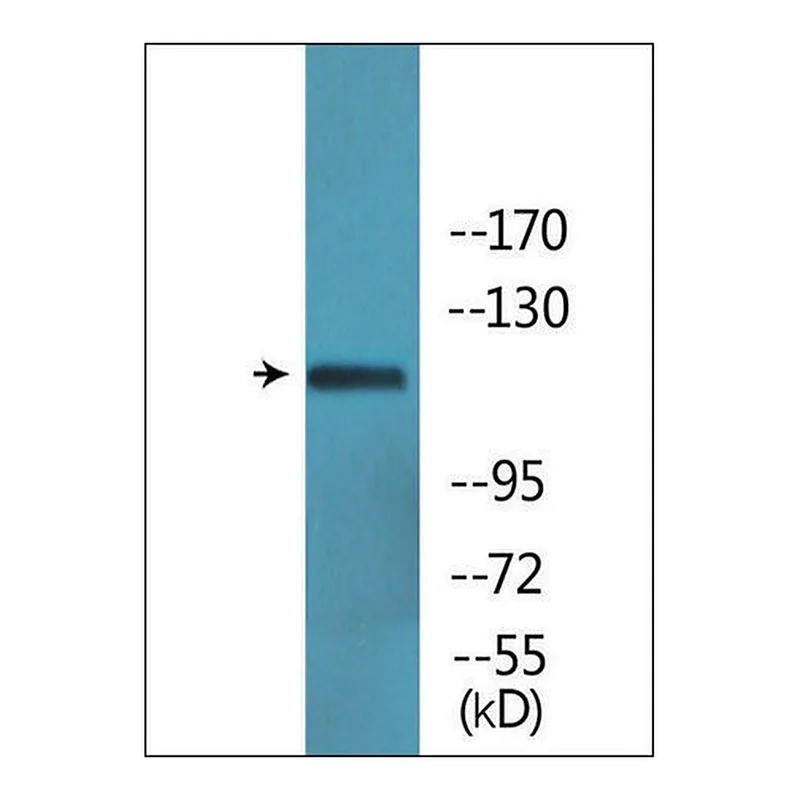 Merck Anti-phospho-Ret (pTyr1062) antibody produced in rabbit