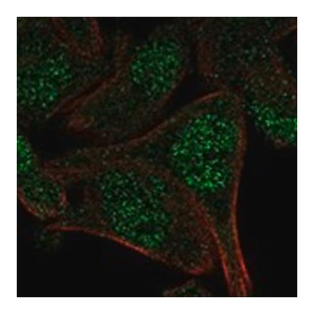 Merck Anti-APPBP2 antibody produced in rabbit