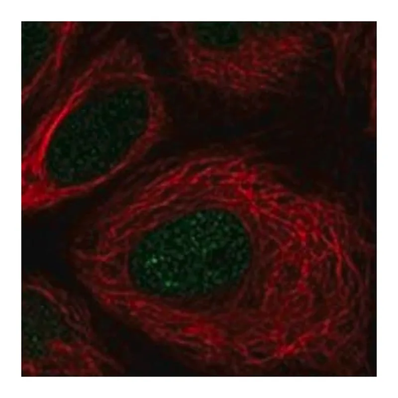 Merck Anti-TSEN54 antibody produced in rabbit