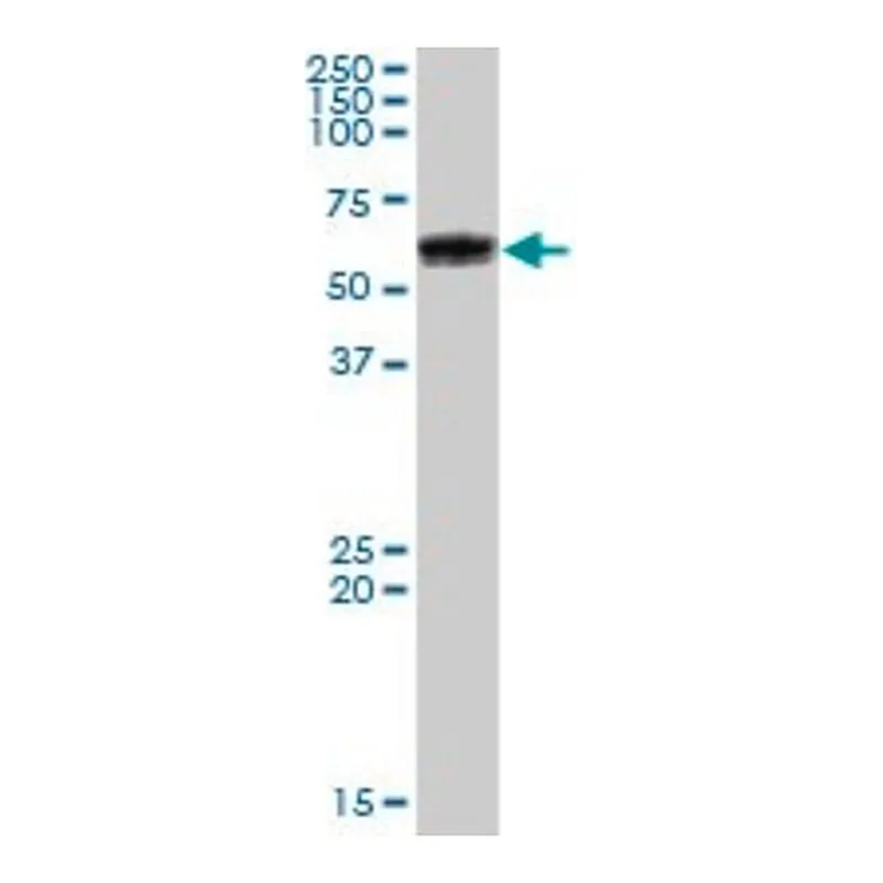 Merck Anti-GBA antibody produced in mouse