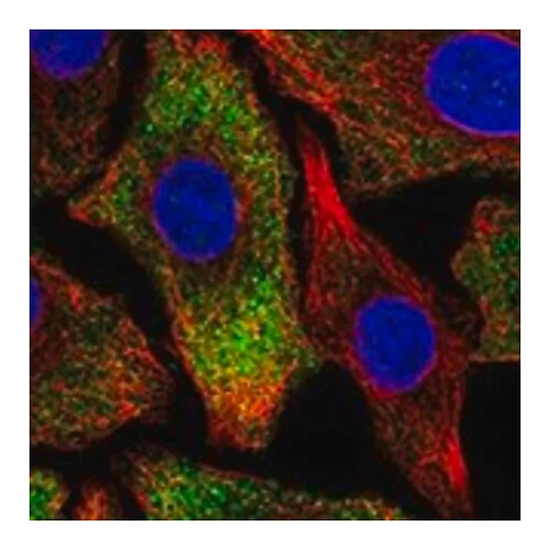Merck Anti-PNPLA6 antibody produced in rabbit