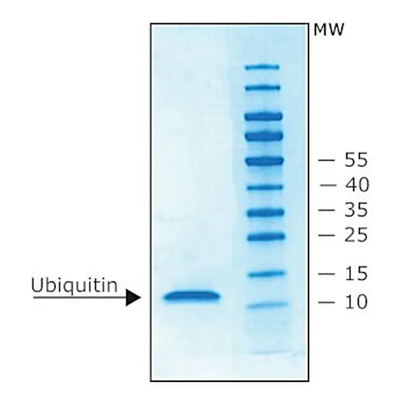 Merck UBIQUITIN. HUMAN RECOMBINANT, N-TERM- IN