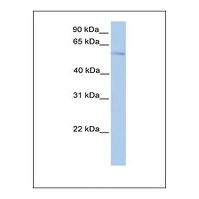Merck Anti-PLAG1