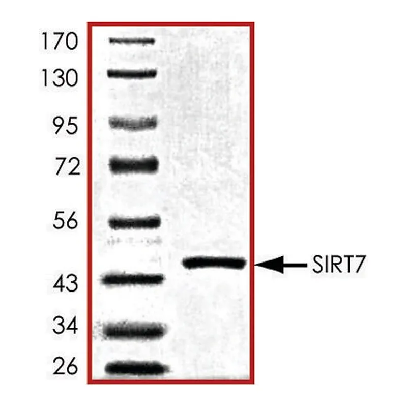 Merck SIRT7, active, His tagged human