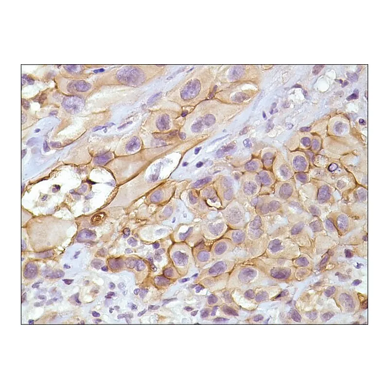 Merck Anti-Mesothelin antibody, Rabbit monoclonal