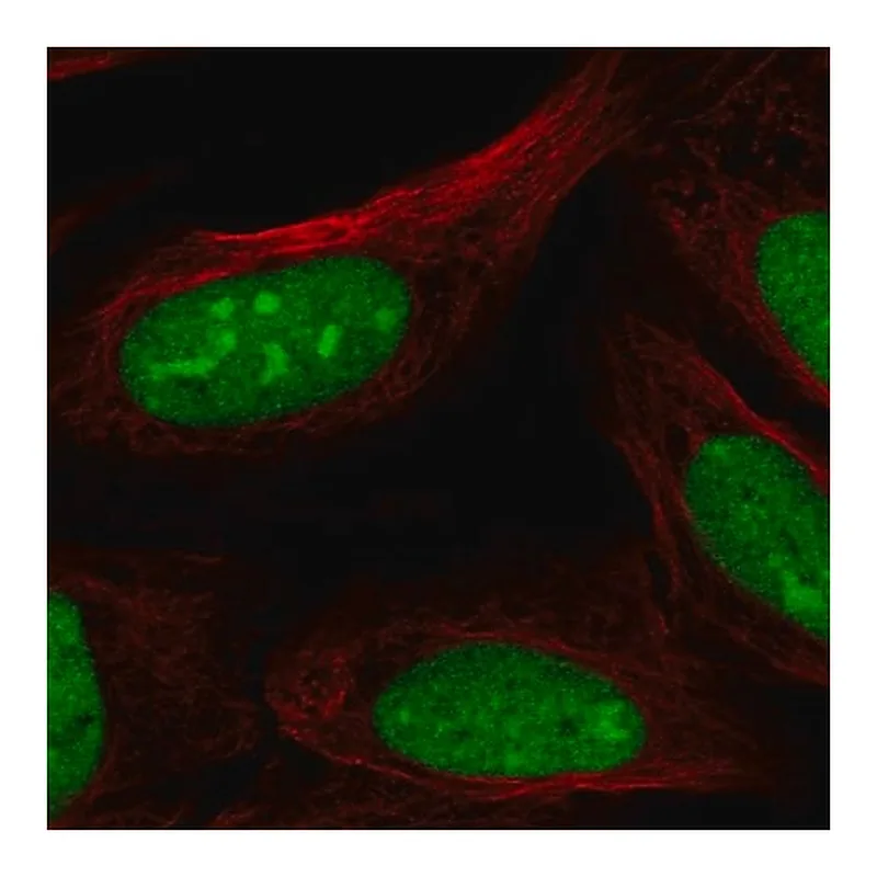 Merck Anti-CRISPLD2 antibody produced in rabbit