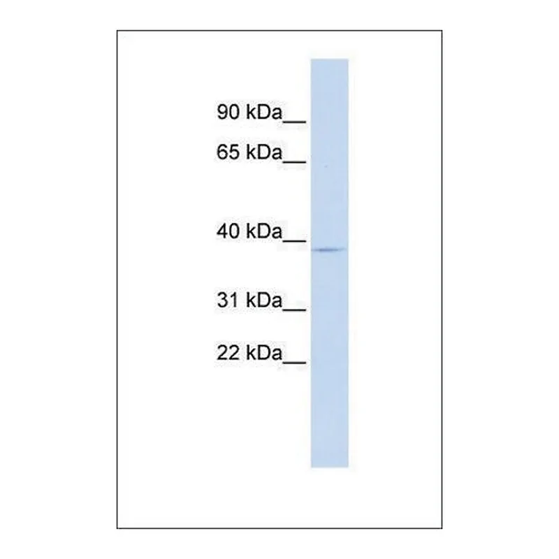 Merck Anti-PITX3 antibody produced in rabbit