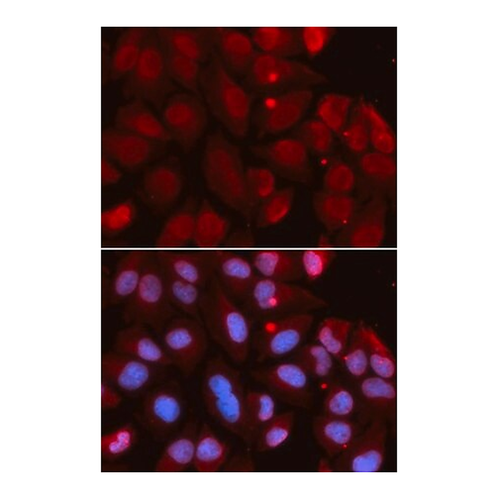 Merck Anti- RAG2 antibody produced in rabbit