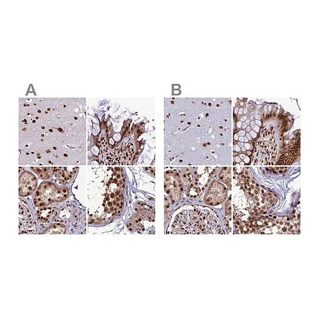 Merck Anti-DDX1 antibody produced in rabbit