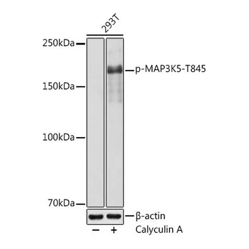 Merck Anti-Phospho-MAP3K5-T845 antibody produced in rabbit