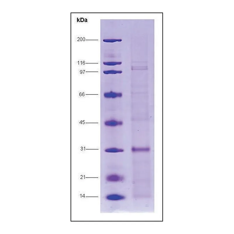 Merck Androgen receptor (650-920), human