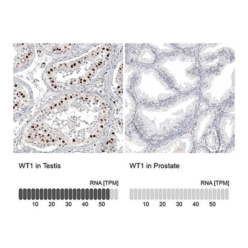 Merck Anti-WT1 antibody produced in mouse