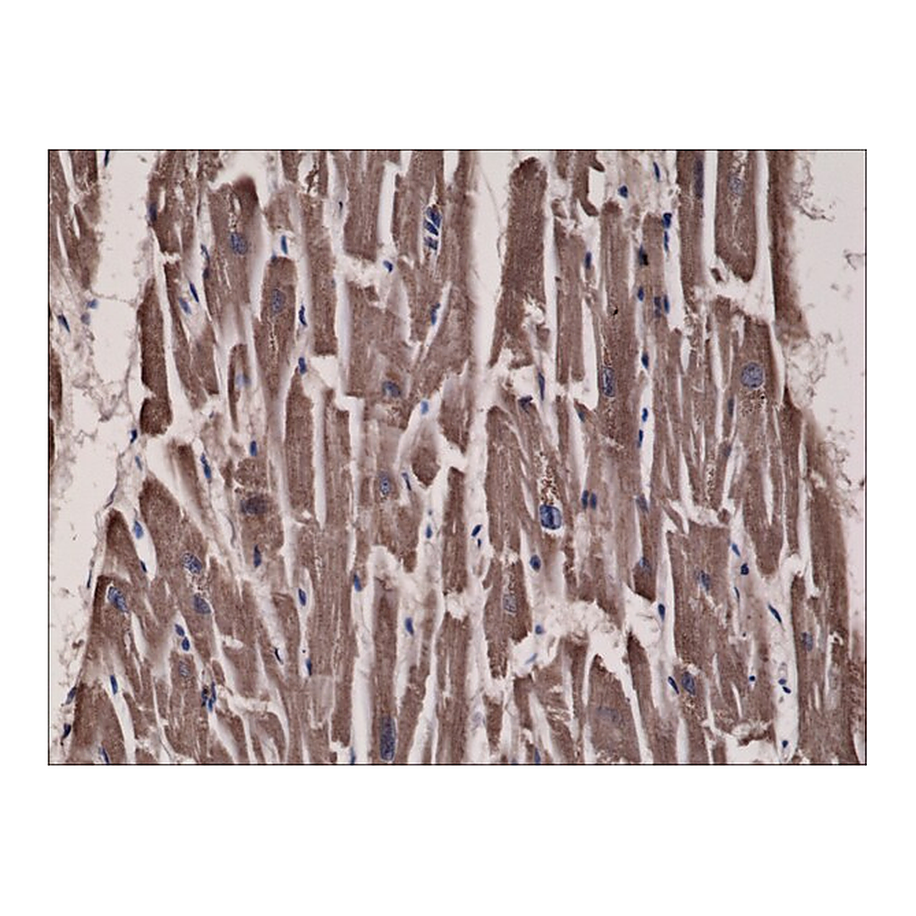 Merck Anti-Acetyl-CoA Carboxylase antibody, Rabbit monoclonal