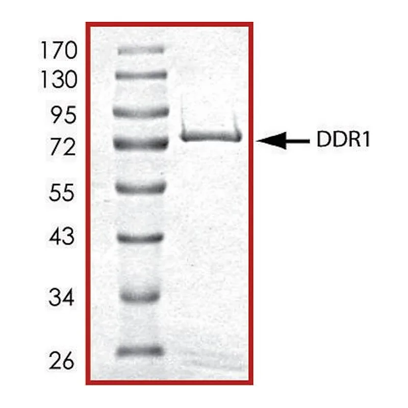 Merck DDR1 (444-end), active, GST tagged human