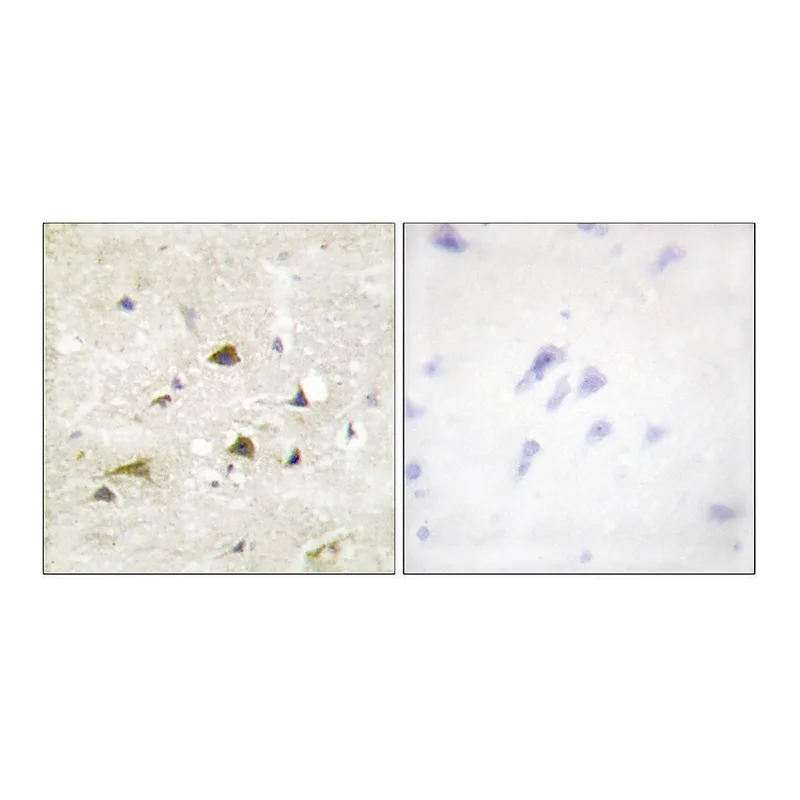 Merck Anti-IKK-beta antibody produced in rabbit