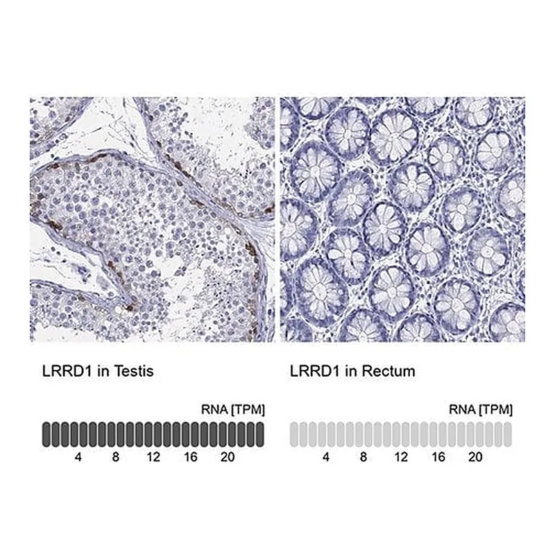 Merck Anti-LRRD1 antibody produced in rabbit