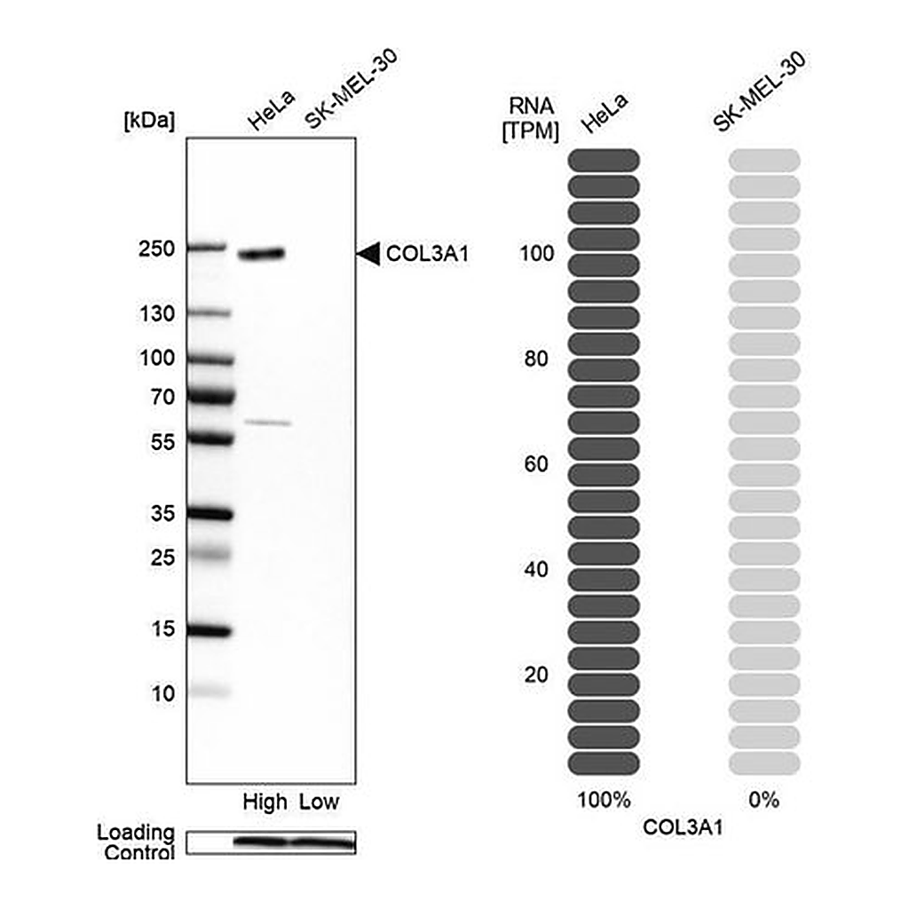 Merck Anti-COL3A1 antibody produced in rabbit
