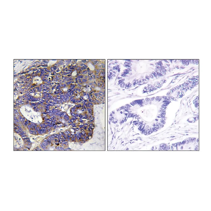 Merck Anti-Collagen IV alpha2 antibody produced in rabbit
