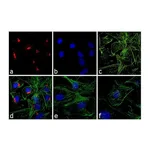 Thermo Fisher Scientific Goat anti-Rabbit IgG (H+L) Cross-Adsorbed Secondary Antibody, Rhodamine Red-X